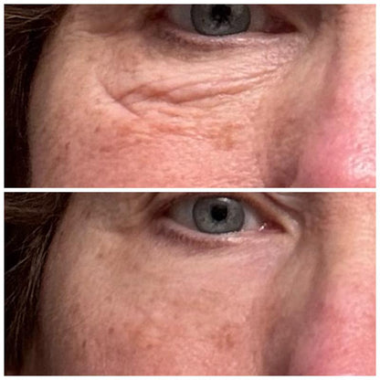 Instant Temporary Face Tightener