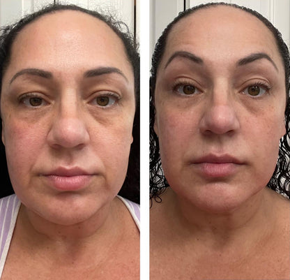 Instant Temporary Face Tightener