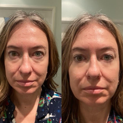 Instant Temporary Face Tightener
